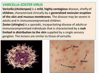 VARICELLA-ZOSTER VIRUS
Varicella (chickenpox) is a mild, highly contagious disease, chieflyof
children, characterized clinically by a generalized vesicular eruption
of the skin and mucous membranes. The disease may be severe in
adults and in immunocompromised children.
Zoster (shingles) is a sporadic, incapacitating disease of adultsor
immunocompromised individuals that is characterized by a rash
limited in distribution to the skin supplied by a single sensory
ganglion. The lesions are similar to those ofvaricella.
 