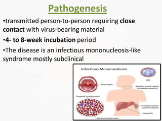 Pathogenesis
•transmitted person-to-person requiring close
contact with virus-bearing material
•4- to 8-week incubation period
•The disease is an infectious mononucleosis-like
syndrome mostly subclinical
 
