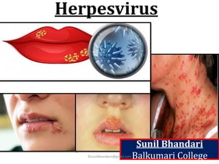 Herpesvirus
Sunil Bhandari
Balkumari College
©sunilbhandariv@gmail.com
 