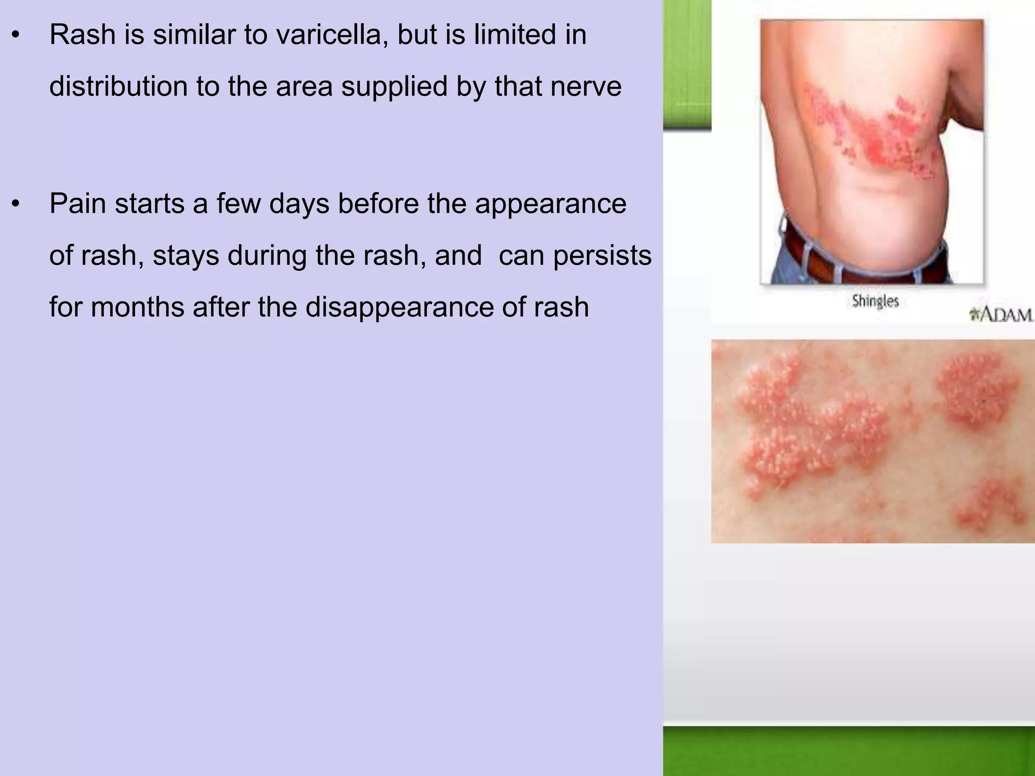 • Rash is similar to varicella, but is limited in
distribution to the area supplied by that nerve
• Pain starts a few days before the appearance
of rash, stays during the rash, and can persists
for months after the disappearance of rash
 