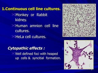 1.Continuous cell line cultures. Monkey or Rabbit kidney. Human amnion cell line cultures. HeLa cell cultures. Cytopathic effects : Well defined foci with heaped up cells & syncitial formation.