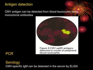 herpesviruses bacteria virus and infection | PPT
