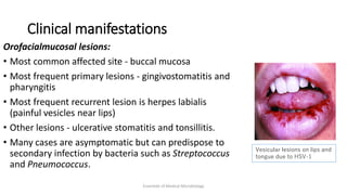 Clinical manifestations
Orofacialmucosal lesions:
• Most common affected site - buccal mucosa
• Most frequent primary lesions - gingivostomatitis and
pharyngitis
• Most frequent recurrent lesion is herpes labialis
(painful vesicles near lips)
• Other lesions - ulcerative stomatitis and tonsillitis.
• Many cases are asymptomatic but can predispose to
secondary infection by bacteria such as Streptococcus
and Pneumococcus.
Essentials of Medical Microbiology
Vesicular lesions on lips and
tongue due to HSV-1
 