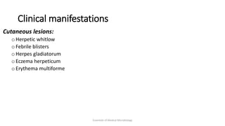Clinical manifestations
Cutaneous lesions:
o Herpetic whitlow
o Febrile blisters
o Herpes gladiatorum
o Eczema herpeticum
o Erythema multiforme
Essentials of Medical Microbiology
 