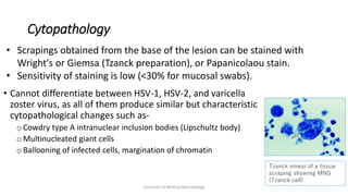Cytopathology
• Cannot differentiate between HSV-1, HSV-2, and varicella
zoster virus, as all of them produce similar but characteristic
cytopathological changes such as-
o Cowdry type A intranuclear inclusion bodies (Lipschultz body)
o Multinucleated giant cells
o Ballooning of infected cells, margination of chromatin
Essentials of Medical Microbiology
• Scrapings obtained from the base of the lesion can be stained with
Wright's or Giemsa (Tzanck preparation), or Papanicolaou stain.
• Sensitivity of staining is low (<30% for mucosal swabs).
Tzanck smear of a tissue
scraping showing MNG
(Tzanck cell)
 
