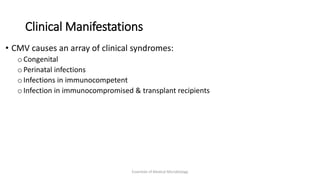 Clinical Manifestations
• CMV causes an array of clinical syndromes:
o Congenital
o Perinatal infections
o Infections in immunocompetent
o Infection in immunocompromised & transplant recipients
Essentials of Medical Microbiology
 