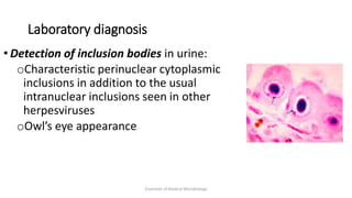 Laboratory diagnosis
• Detection of inclusion bodies in urine:
oCharacteristic perinuclear cytoplasmic
inclusions in addition to the usual
intranuclear inclusions seen in other
herpesviruses
oOwl’s eye appearance
Essentials of Medical Microbiology
 