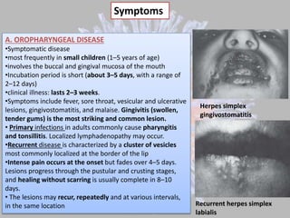 Herpes virus infections   copy
