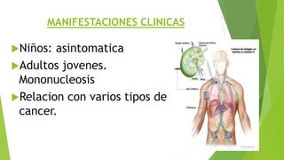 MANIFESTACIONES CLINICAS
Niños: asintomatica
Adultos jovenes.
Mononucleosis
Relacion con varios tipos de
cancer.
 