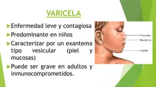 VARICELA
Enfermedad leve y contagiosa
Predominante en niños
Caracterizar por un exantema
tipo vesicular (piel y
mucosas)
Puede ser grave en adultos y
inmunocomprometidos.
 