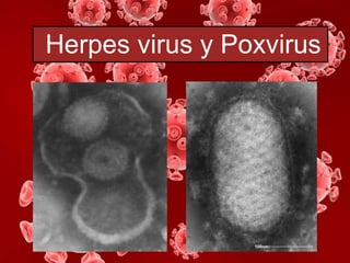 Herpes virus y Poxvirus

 