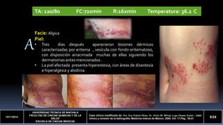 14/11/2014 
UNIVERSIDAD TECNICA DE MACHALA 
FACULTAD DE CINCIAS QUIMICAS Y DE LA 
SALUD 
ESCUELA DE CINCIAS MEDICAS 
Caso clínico modificado de: Dra. Eva Chávez Pérez. Dr. Víctor M. Whizar Lugo.Herpes Zoster : caso 
clínico y revisión de la bibliografía. Medicina Interna de México. 2005. Vol. 17.Pág.: 38-41 5/24 
A 
P 
TA: 120/80 FC:72xmin R:16xmin Temperatura: 36.2 C 
Facie: Algica 
Piel: 
• Tres días después aparecieron lesiones dérmicas 
caracterizadas por eritema , vesícula con fondo eritematoso, 
con disposición arracimada muchas de ellas siguiendo los 
dermatomas antes mencionados . 
• La piel afectada presenta hiperestesia, con áreas de disestesia 
e hiperalgesia y alodinia. 
Leucocitos de 6300, descenso de linfocitos CD4 de 120 cel/mm3. 
 