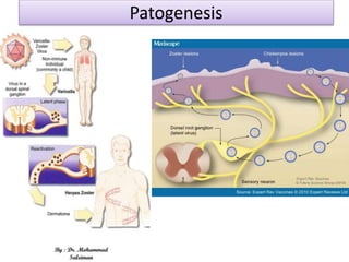 Patogenesis
 