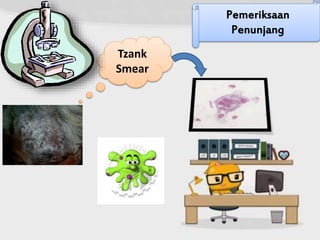 Pemeriksaan
Penunjang
Tzank
Smear
 