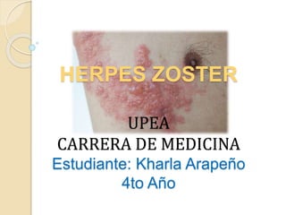 HERPES ZOSTER
UPEA
CARRERA DE MEDICINA
Estudiante: Kharla Arapeño
4to Año
 