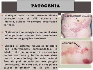 PATOGENIA

 La mayor parte de las personas tienen
  contacto con el VVZ durante la
  infancia, aunque no siempre desarrollen
  varicela.

 El sistema inmunológico elimina el virus
  del organismo, aunque éste permanece
  latente en los ganglios nerviosos.

 Cuando el sistema inmune se deteriora
  (con determinadas enfermedades, la
  edad...) el virus se reactiva y se replica
  en las neuronas, y forma nuevos virus
  que circulan a lo largo del axón hacia el
  área de piel inervada por ese ganglio
  (dermatoma). Una vez ahí, el virus puede
  causar inflamación de la piel con
 