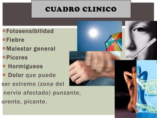 CUADRO CLINICO


Fotosensibilidad
Fiebre
Malestar general
Picores
 Hormigueos
 Dolor que puede
ser extremo (zona del
 nervio afectado) punzante,
urente, picante.
 