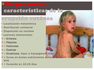 Herpes zoster:
 características de la
erupción cutánea
• Localización metamérica
• Distribución unilateral
• Disposición en racimos
• Lesiones elementales:
 – Eritema
 – Pápulas
 – Vesículas
 – Costras
 – Cicatrices, hiper o hipopigmentación.
 • Curso en brotes subintrantes durante siete
  días
 • Curación en 10-15 días
 