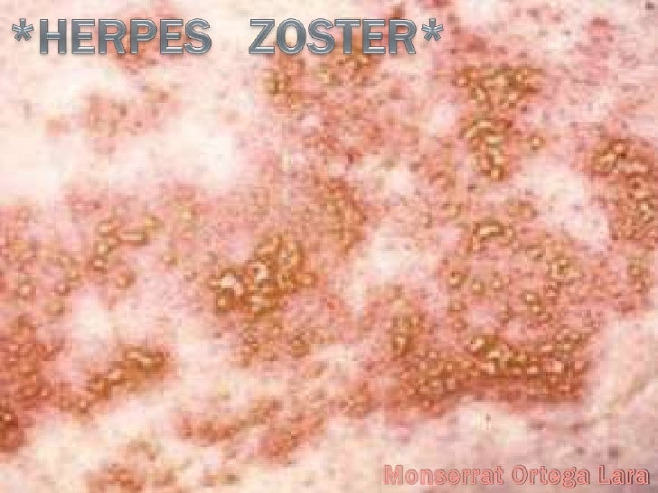 herpes dating in san antonio Herpes suppor group in san antonio ,meet herpes singles in san antonio. herpes dating in san antonio Herpes suppor group in san antonio ,meet herpes singles in san antonio.