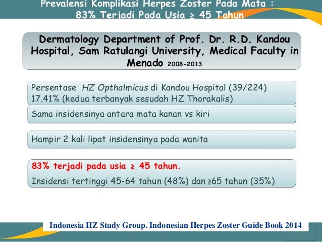 Herpes Zoster Dan Nyeri Pasca Herpes By Dr Prasna
