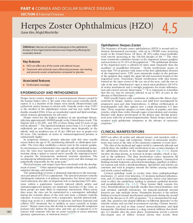Herpes zoster ophthalmicus