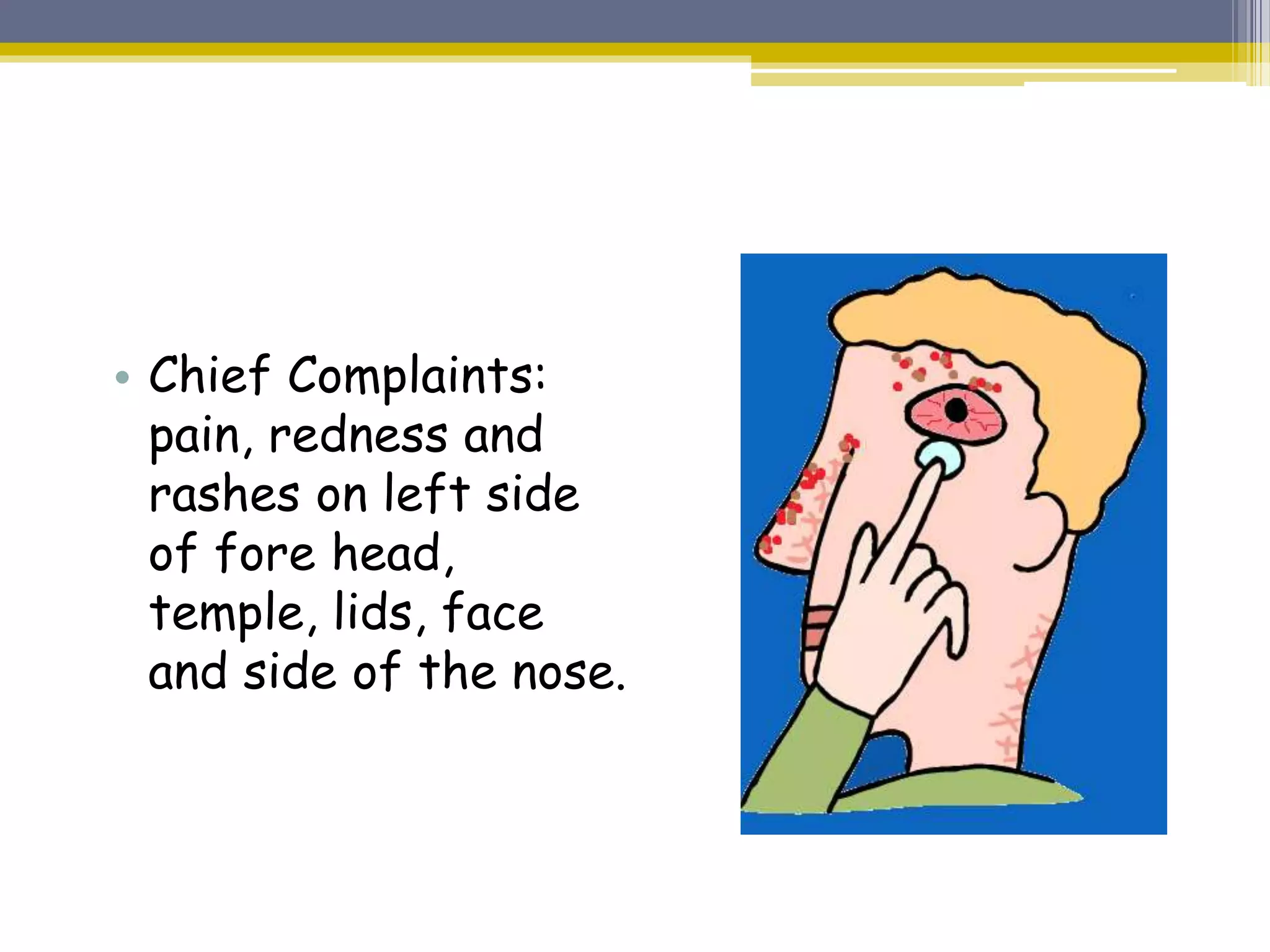 Temple Rash Herpes zoster ophthalmicus | PPTX