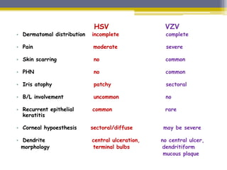 Herpes zoster ophthalmicus | PPTX