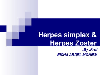 Herpes simplex &
Herpes Zoster
By .Prof.
EISHA ABDEL MONIEM
 