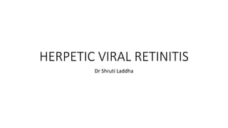HERPETIC VIRAL RETINITIS
Dr Shruti Laddha
 
