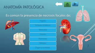 ANATOMÍA PATOLÓGICA
Hígado
Nódulos linfáticos
Testículos
Ovarios
Pulmones
Riñones
Órganos linfoides.
7
Es común la presencia de necrosis focales de;
 