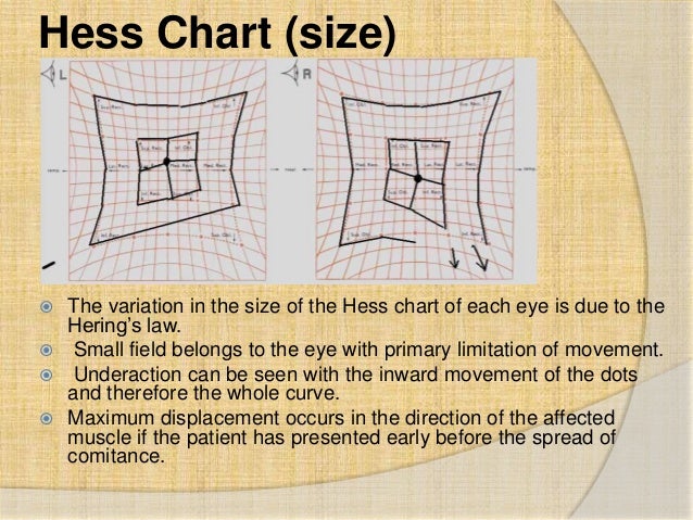 Hess Chart