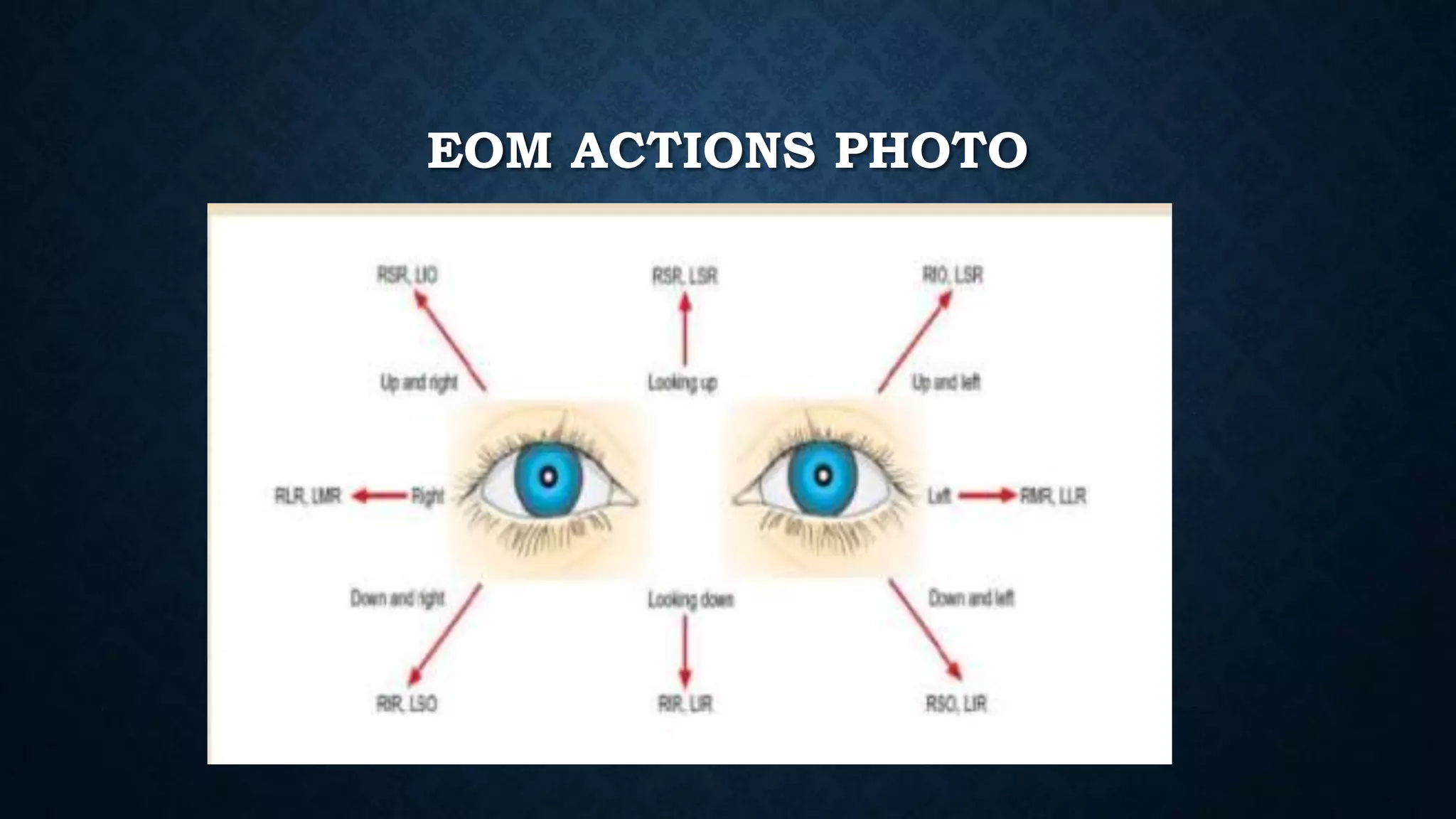 EOM ACTIONS PHOTO
 