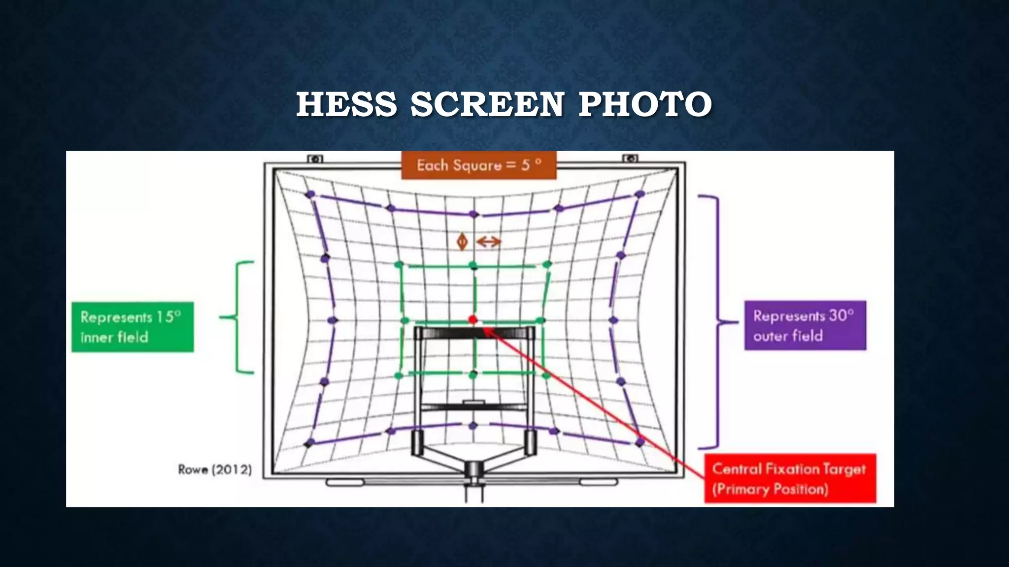 HESS SCREEN PHOTO
 