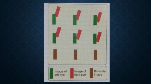 Diplopia Chart Normal Hess chart, diplopia chart, cover tests | PPTX