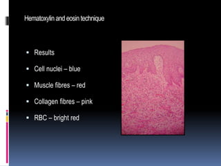 Hematoxylinand eosintechnique
 Results
 Cell nuclei – blue
 Muscle fibres – red
 Collagen fibres – pink
 RBC – bright red
 