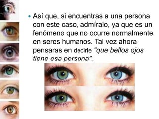 Así que, si encuentras a una persona
con este caso, admíralo, ya que es un
fenómeno que no ocurre normalmente
en seres humanos. Tal vez ahora
pensaras en decirle “que bellos ojos
tiene esa persona”.
 