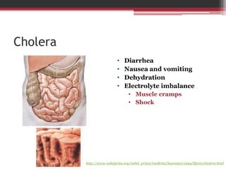 Cholera
                            •    Diarrhea
                            •    Nausea and vomiting
                            •    Dehydration
                            •    Electrolyte imbalance
                                   • Muscle cramps
                                   • Shock




          http://www.nobelprize.org/nobel_prizes/medicine/laureates/1994/illpres/cholera.html
 