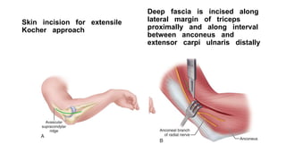 Heterotrophic ossification | PPTX
