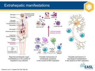 Extrahepatic manifestations
Pischke S, et al. J Hepatol 2017;66:1082–95
Reported extrahepatic organ
manifestations in the context of
hepatitis E virus infection
Possible mechanisms of
extrahepatic symptoms
in the context of HEV replication
Possible mechanisms of
neurological manifestations
in the absence of HEV replication
 