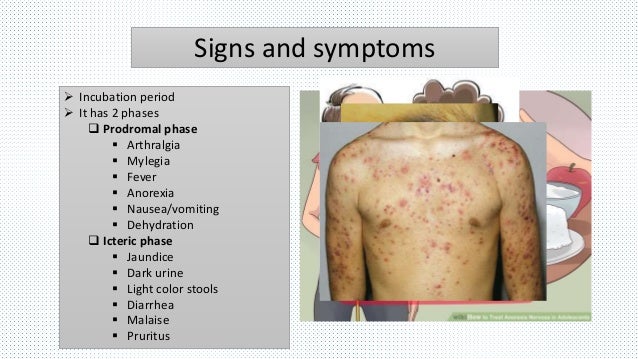 Hepatitis E Virus Presentation