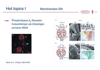Hot topics I Membranöse GN
Beck et al, N Engl J Med 2009
Phospholipase A2 Rezeptor-
Autoantikörper als Zielantigen
primären MGN
 