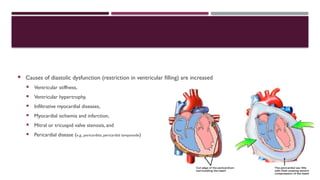  Causes of diastolic dysfunction (restriction in ventricular filling) are increased
 Ventricular stiffness,
 Ventricular hypertrophy,
 Infiltrative myocardial diseases,
 Myocardial ischemia and infarction,
 Mitral or tricuspid valve stenosis, and
 Pericardial disease (e.g., pericarditis, pericardial tamponade)
 