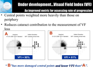 Under development…Visual Field Index (VFI)   An improved metric for assessing rate of progression Central points weighted more heavily than those on periphery Reduces cataract contribution to the measurement of VF loss “  B ”has more damaged central points  and lower VFI  than“ A ”. A B VFI = 90% VFI = 81% 