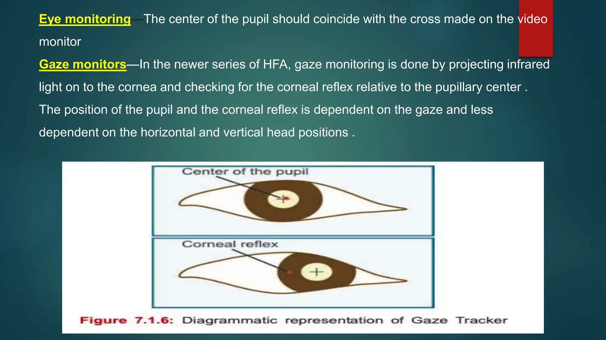 Eye monitoring—The center of the pupil should coincide with the cross made on the video
monitor
Gaze monitors—In the newer series of HFA, gaze monitoring is done by projecting infrared
light on to the cornea and checking for the corneal reflex relative to the pupillary center .
The position of the pupil and the corneal reflex is dependent on the gaze and less
dependent on the horizontal and vertical head positions .
 