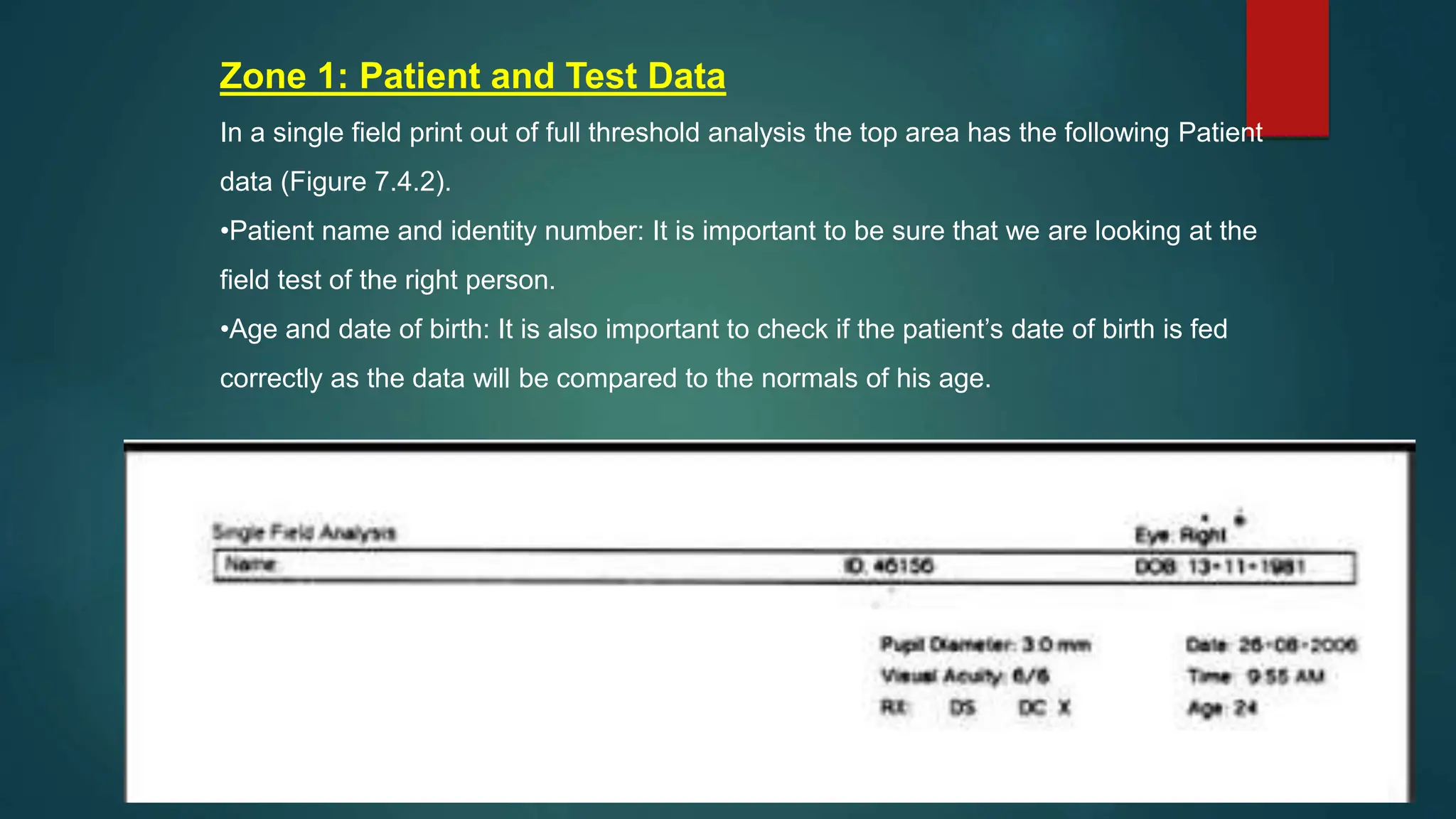 Zone 1: Patient and Test Data
In a single field print out of full threshold analysis the top area has the following Patient
data (Figure 7.4.2).
•Patient name and identity number: It is important to be sure that we are looking at the
field test of the right person.
•Age and date of birth: It is also important to check if the patient’s date of birth is fed
correctly as the data will be compared to the normals of his age.
 