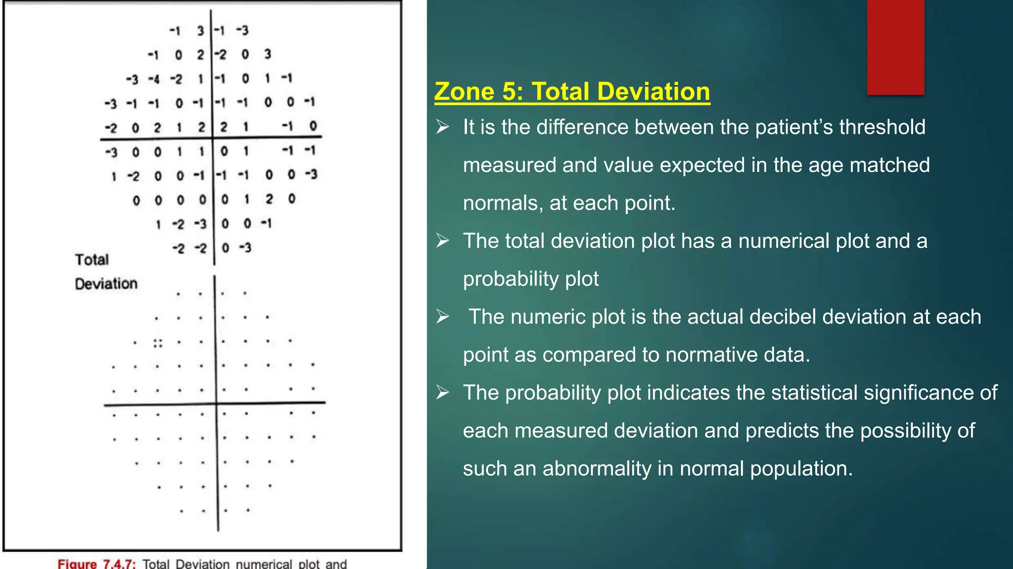 Zone 5: Total Deviation
 It is the difference between the patient’s threshold
measured and value expected in the age matched
normals, at each point.
 The total deviation plot has a numerical plot and a
probability plot
 The numeric plot is the actual decibel deviation at each
point as compared to normative data.
 The probability plot indicates the statistical significance of
each measured deviation and predicts the possibility of
such an abnormality in normal population.
 