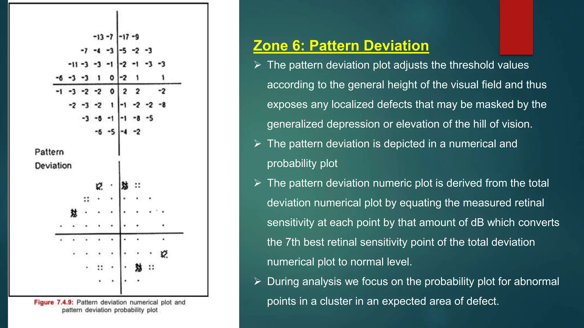 Zone 6: Pattern Deviation
 The pattern deviation plot adjusts the threshold values
according to the general height of the visual field and thus
exposes any localized defects that may be masked by the
generalized depression or elevation of the hill of vision.
 The pattern deviation is depicted in a numerical and
probability plot
 The pattern deviation numeric plot is derived from the total
deviation numerical plot by equating the measured retinal
sensitivity at each point by that amount of dB which converts
the 7th best retinal sensitivity point of the total deviation
numerical plot to normal level.
 During analysis we focus on the probability plot for abnormal
points in a cluster in an expected area of defect.
 