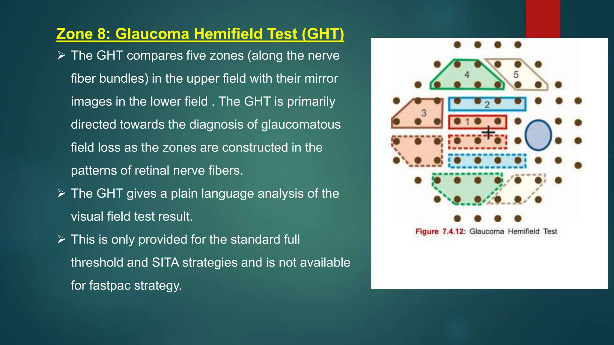 Zone 8: Glaucoma Hemifield Test (GHT)
 The GHT compares five zones (along the nerve
fiber bundles) in the upper field with their mirror
images in the lower field . The GHT is primarily
directed towards the diagnosis of glaucomatous
field loss as the zones are constructed in the
patterns of retinal nerve fibers.
 The GHT gives a plain language analysis of the
visual field test result.
 This is only provided for the standard full
threshold and SITA strategies and is not available
for fastpac strategy.
 