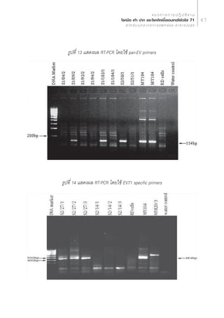 · π « ∑ “ ß ° “ √ ª Ø‘ ∫— µ‘ ß “ π
                              ‚√§¡◊Õ ‡∑â“ ª“° ·≈–‚√§µ‘¥‡™◊ÈÕ‡Õπ‡∑Õ‚√‰«√—  71                     47
                                   ” À √— ∫ ∫ÿ § ≈ “ ° √ ° “ √ · æ ∑ ¬å · ≈ –   “ ∏ “ √ ≥  ÿ ¢




   √Ÿª∑’Ë 13 · ¥ßº≈ RT-PCR ‚¥¬„™â pan-EV primers




√Ÿª∑’Ë 14 · ¥ßº≈ RT-PCR ‚¥¬„™â EV71 specific primers
 