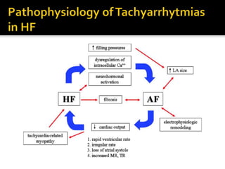 Heart Failure Rythm Heart Failure and Arrhythmia | PPTX